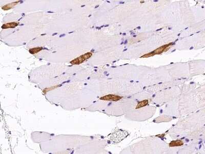 Immunohistochemistry-Paraffin: Myosin Light Chain 2 Antibody [NBP2-99552]