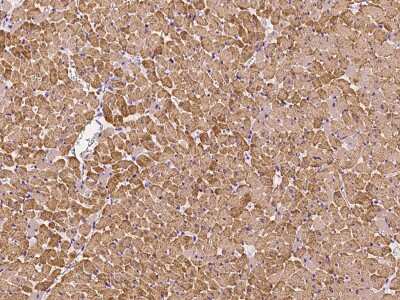 Immunohistochemistry-Paraffin: Myosin Light Chain 2 Antibody [NBP2-99552]