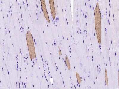 Immunohistochemistry-Paraffin: Myosin Light Chain 2 Antibody [NBP2-99552]