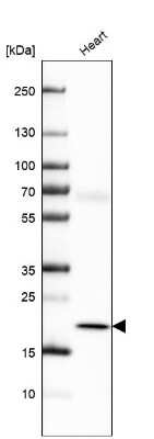 Western Blot: Myosin Light Chain 2 Antibody [NBP1-85541]