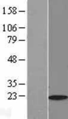 Western Blot: Myosin Light Chain 2 Overexpression Lysate [NBL1-13424]