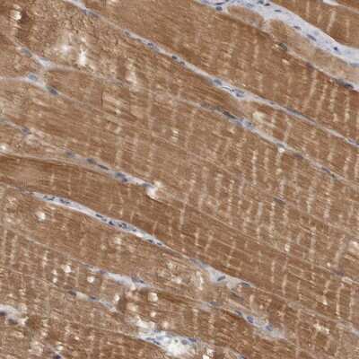 Immunohistochemistry-Paraffin: Myosin Phosphatase 2 Antibody [NBP1-87750]