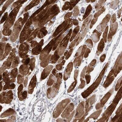 Immunohistochemistry-Paraffin: Myosin Phosphatase 2 Antibody [NBP1-87751]