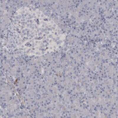 Immunohistochemistry-Paraffin: Myosin Phosphatase 2 Antibody [NBP1-87751]