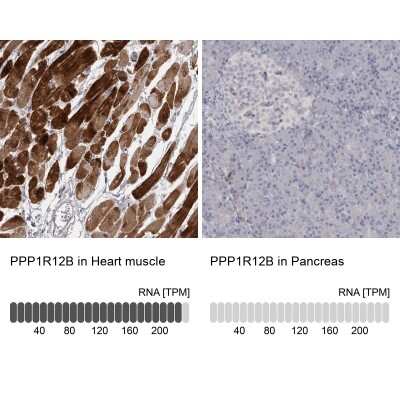 Immunohistochemistry-Paraffin: Myosin Phosphatase 2 Antibody [NBP1-87751]