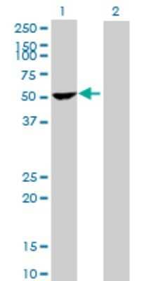 Western Blot: Myosin Phosphatase 2 Antibody [H00004660-B02P]