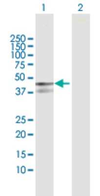 Western Blot: Myosin Phosphatase 2 Antibody [H00004660-D01P]