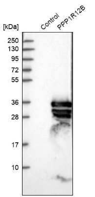 Western Blot: Myosin Phosphatase 2 Antibody [NBP1-87751]