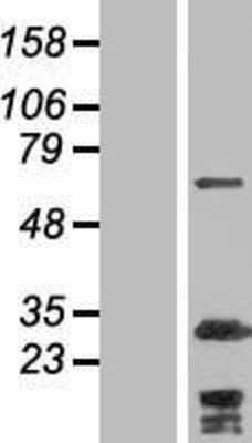 Western Blot: Myosin Phosphatase 2 Overexpression Lysate [NBP2-06087]