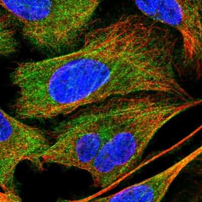 Immunocytochemistry/ Immunofluorescence: Myosin Phosphatase Antibody [NBP2-58950]