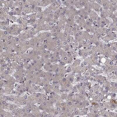 Immunohistochemistry-Paraffin: Myosin Phosphatase Antibody [NBP2-68929]