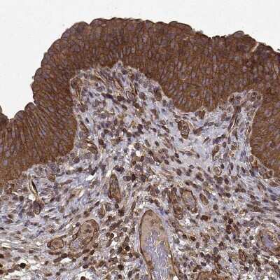 Immunohistochemistry-Paraffin: Myosin Phosphatase Antibody [NBP2-68929]
