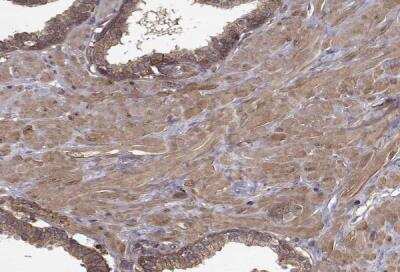 Immunohistochemistry-Paraffin: Myosin Phosphatase Antibody [NBP2-68929]