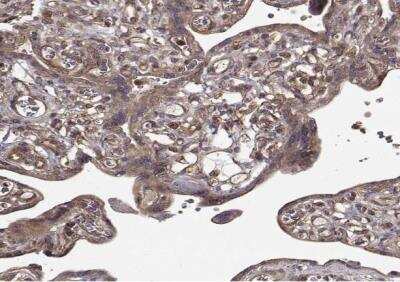 Immunohistochemistry-Paraffin: Myosin Phosphatase Antibody [NBP2-68929]