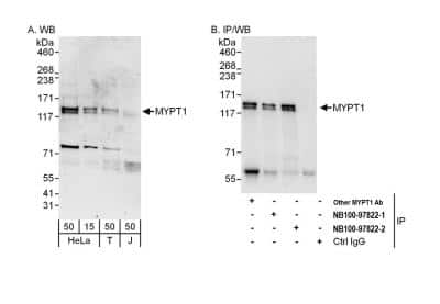 Western Blot: Myosin Phosphatase Antibody [NB110-38889]