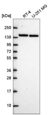 Western Blot: Myosin Phosphatase Antibody [NBP2-68929]