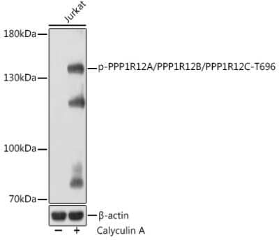 Western Blot: Myosin Phosphatase [p Thr696] AntibodyAzide and BSA Free [NBP3-16931]