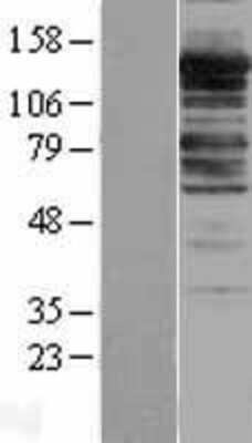 Western Blot: Myosin Phosphatase Overexpression Lysate [NBL1-14674]