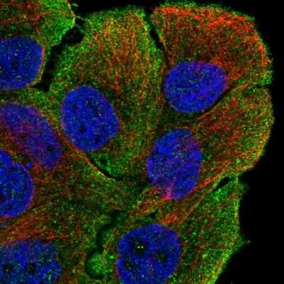 Immunocytochemistry/ Immunofluorescence: Myosin VB Antibody [NBP2-57769]