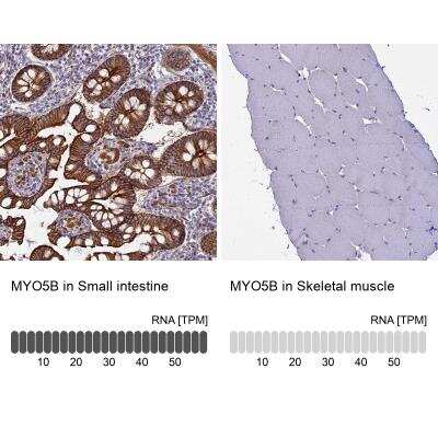 Immunohistochemistry-Paraffin: Myosin VB Antibody [NBP1-87746]