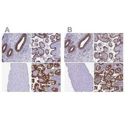 Immunohistochemistry-Paraffin: Myosin VB Antibody [NBP1-87747]