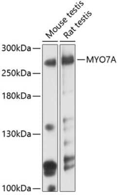 Western Blot: Myosin VIIa AntibodyAzide and BSA Free [NBP2-93677]