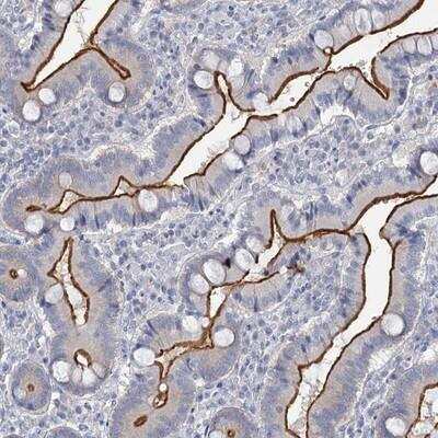 Immunohistochemistry-Paraffin: Myosin VIIb Antibody [NBP1-87506]