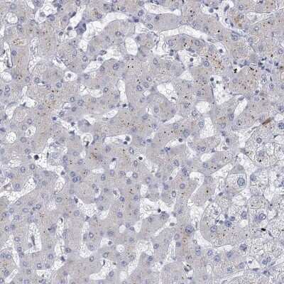 Immunohistochemistry-Paraffin: Myosin VIIb Antibody [NBP1-87506]