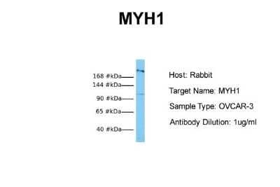 Western Blot: Myosin Heavy Chain 1 Antibody [NBP1-57681]