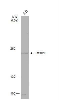 Western Blot: Myosin Heavy Chain 1 Antibody [NBP2-15029]