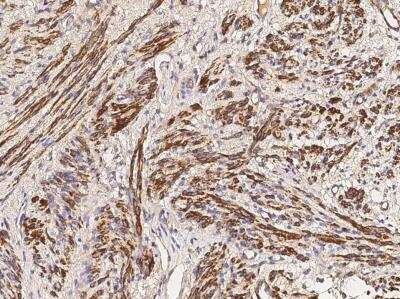 Immunohistochemistry-Paraffin: Myosin heavy chain 11 Antibody (160) [NBP2-89243]