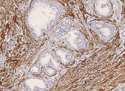 Immunohistochemistry-Paraffin: Myosin heavy chain 11 Antibody (160) [NBP2-89243]