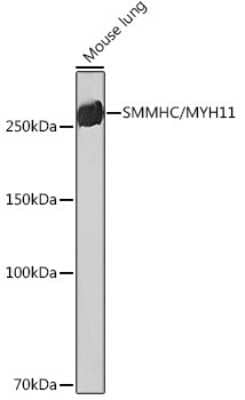 Western Blot: Myosin heavy chain 11 Antibody (0O4O4) [NBP3-16323]