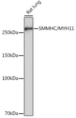 Western Blot: Myosin heavy chain 11 Antibody (0O4O4) [NBP3-16323]