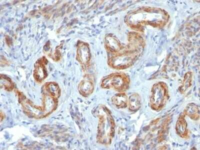 Immunohistochemistry-Paraffin: Myosin heavy chain 11 Antibody (ID8) - Azide and BSA Free [NBP2-47899]