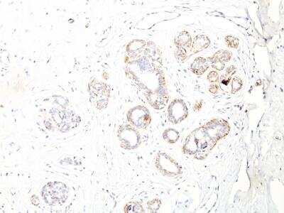 Immunohistochemistry-Paraffin: Myosin heavy chain 11 Antibody (ID8) - IHC-Prediluted [NBP2-48447]