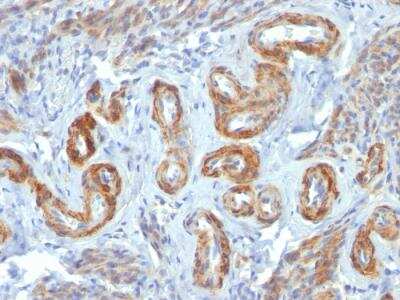 Immunohistochemistry-Paraffin: Myosin heavy chain 11 Antibody (ID8) - IHC-Prediluted [NBP2-48447]