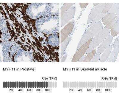 Immunohistochemistry-Paraffin: Myosin heavy chain 11 Antibody [NBP1-87025]