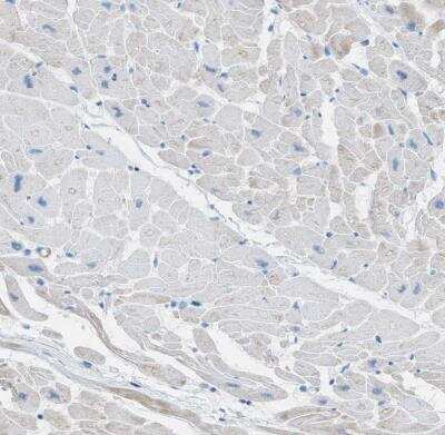 Immunohistochemistry-Paraffin: Myosin heavy chain 11 Antibody [NBP1-87025]