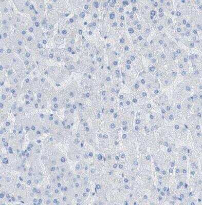 Immunohistochemistry-Paraffin: Myosin heavy chain 11 Antibody [NBP1-87025]