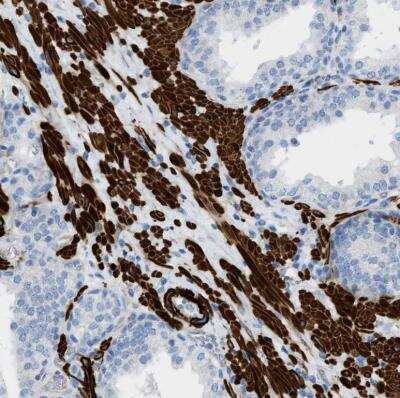 Immunohistochemistry-Paraffin: Myosin heavy chain 11 Antibody [NBP1-87025]