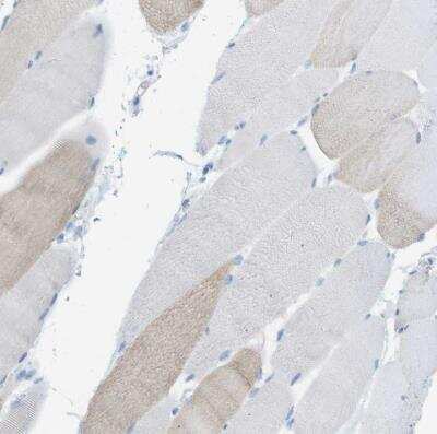 Immunohistochemistry-Paraffin: Myosin heavy chain 11 Antibody [NBP1-87025]