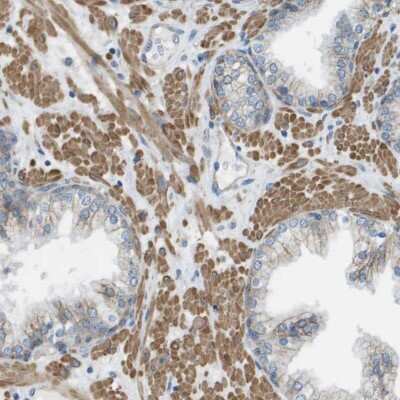 Immunohistochemistry-Paraffin: Myosin heavy chain 11 Antibody [NBP1-87026]