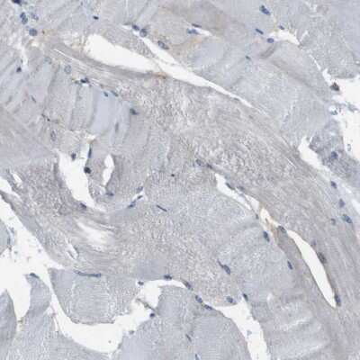 Immunohistochemistry-Paraffin: Myosin heavy chain 11 Antibody [NBP1-87026]