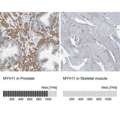 Immunohistochemistry-Paraffin: Myosin heavy chain 11 Antibody [NBP1-87026]
