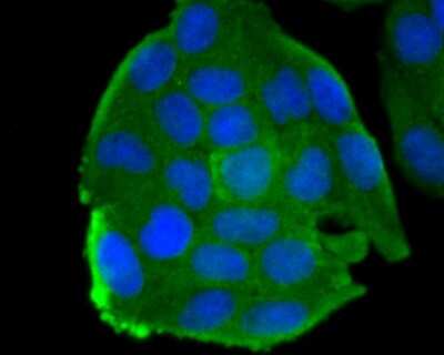 Immunocytochemistry/ Immunofluorescence: Myosin heavy chain 11 Antibody (JA03-35) [NBP2-66967]