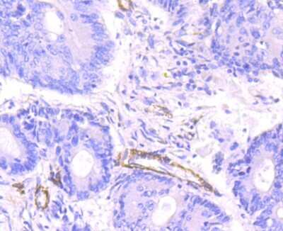 Immunohistochemistry-Paraffin: Myosin heavy chain 11 Antibody (JA03-35) [NBP2-66967]