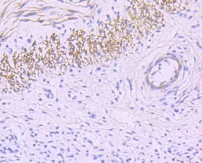 Immunohistochemistry-Paraffin: Myosin heavy chain 11 Antibody (JA03-35) [NBP2-66967]