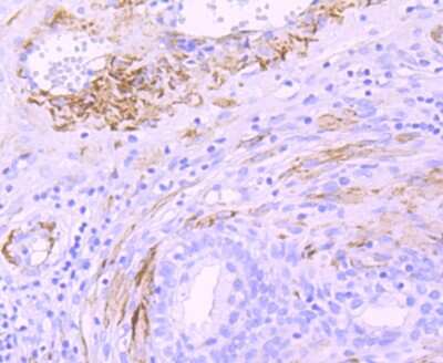 Immunohistochemistry-Paraffin: Myosin heavy chain 11 Antibody (JA03-35) [NBP2-66967]