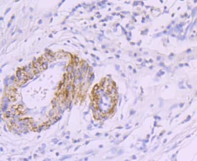 Immunohistochemistry-Paraffin: Myosin heavy chain 11 Antibody (JA03-35) [NBP2-66967]